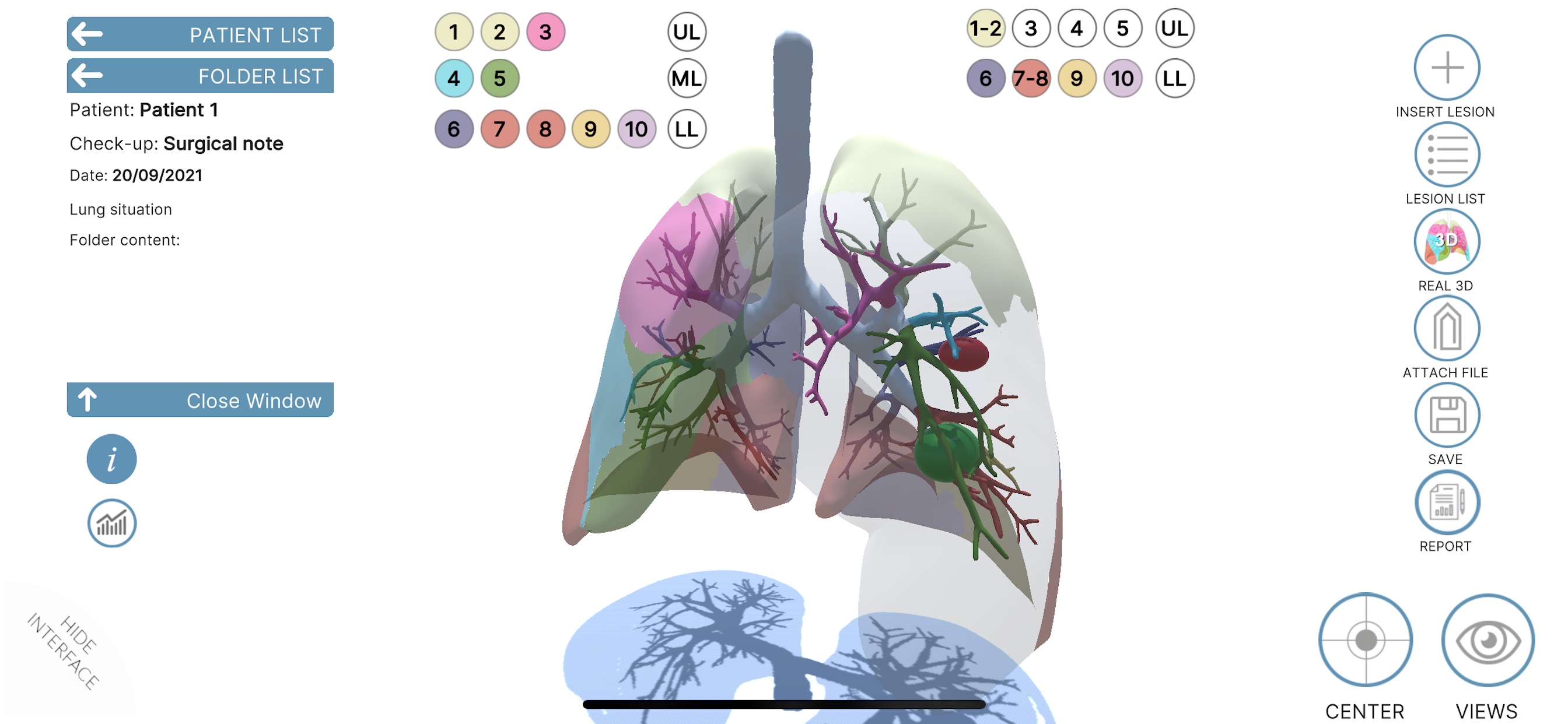 LUNG-NOTE
