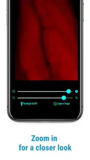 veinscanner pro iphone screenshot 4