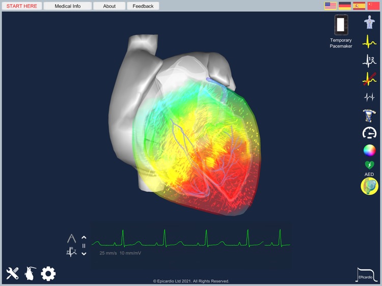 Epicardio Heart Simulator screenshot-7
