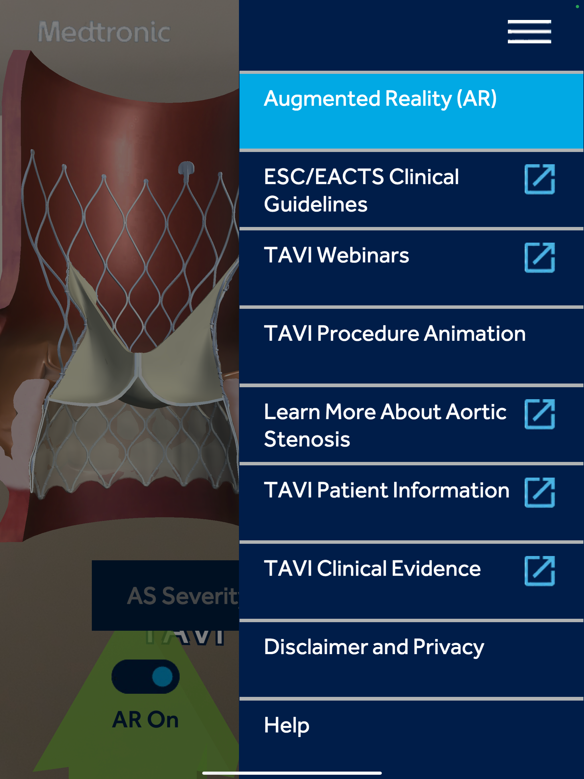 Aortic Stenosis Evolut™ TAVI