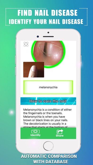 Find Nail Disease Screenshot