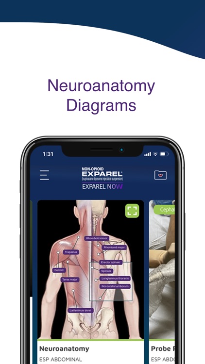 EXPAREL® NOW screenshot-3