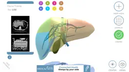 Game screenshot LIVER-NOTE.Edu mod apk