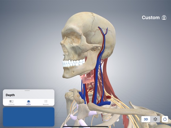 3D Cervical Dystonia