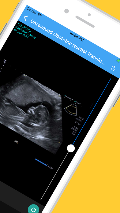Screenshot #3 pour Lime Radiology Patient Access