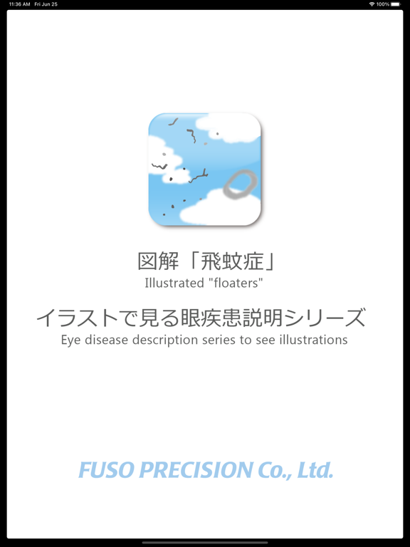 図解「飛蚊症」イラストで見る眼疾患説明シリーズのおすすめ画像1