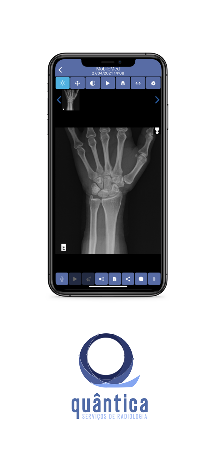 Quântica Telerradiologia