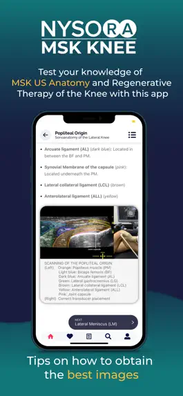 Game screenshot NYSORA MSK US Knee mod apk