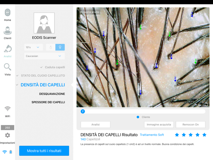 EODIS Hair and Scalp Scanner