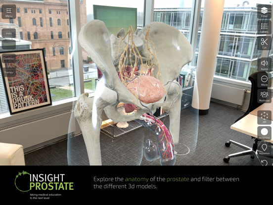INSIGHT PROSTATE Screenshots