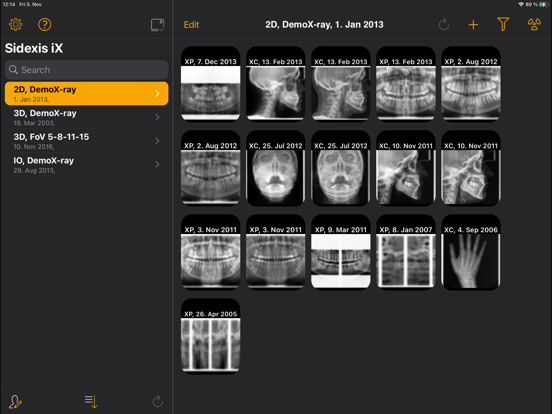 Screenshot #5 pour SIDEXIS iX