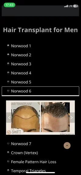Game screenshot SHIFT Hair Transplant hack