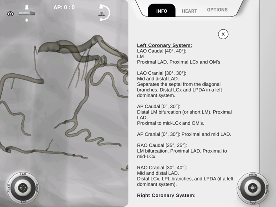 AngioAID 3D iPad screenshot 5 - Medical app