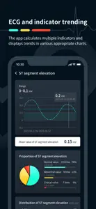 AionECG screenshot #3 for iPhone