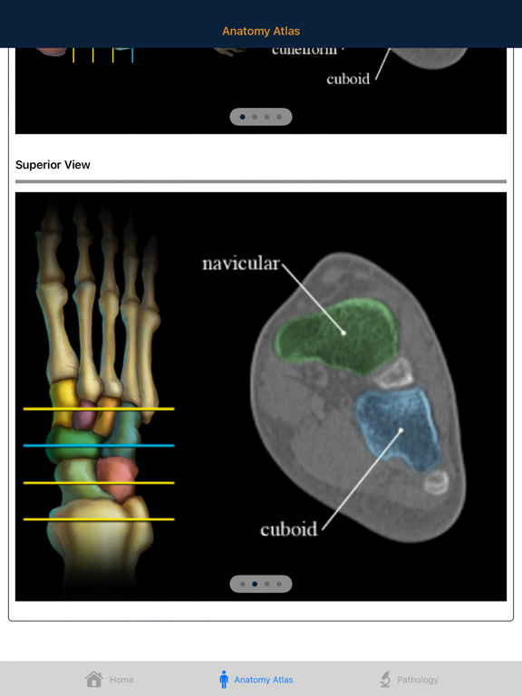 CTisus: CT of the Foot iPad screenshot 5 - Medical app