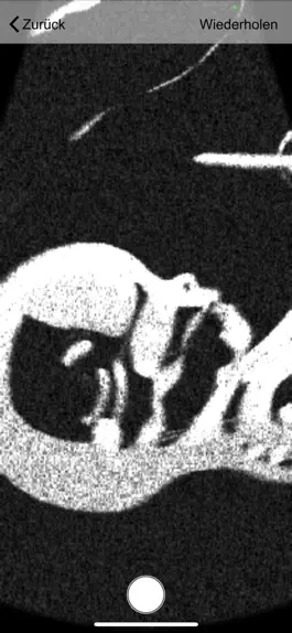 The app Ultraschall Game screenshot Ultraschall apk