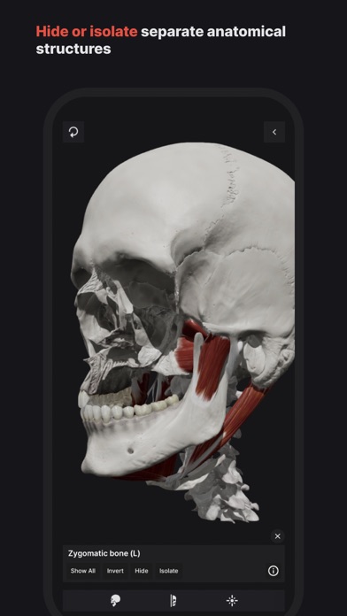 Skull, Teeth & TMJ Screenshot