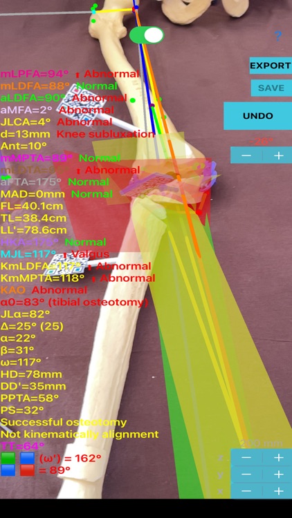 CorectiAR screenshot-7