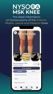 nysora msk us knee problems & solutions and troubleshooting guide - 4