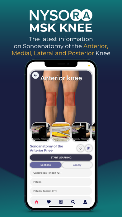 NYSORA MSK US Kneeのおすすめ画像1