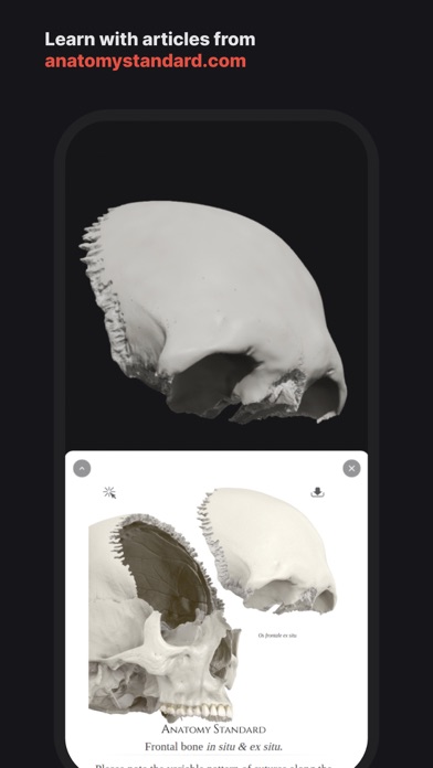 Skull, Teeth & TMJ Screenshot