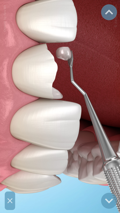 Dental 3D Illustrations Screenshot