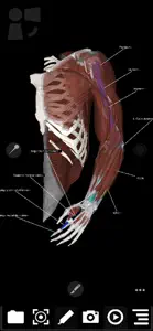 3Dissect Upper Limb screenshot #6 for iPhone