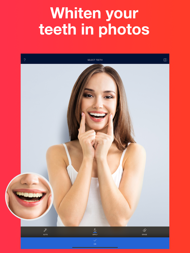 ‎Teeth Whitener - Photo Editor Screenshot