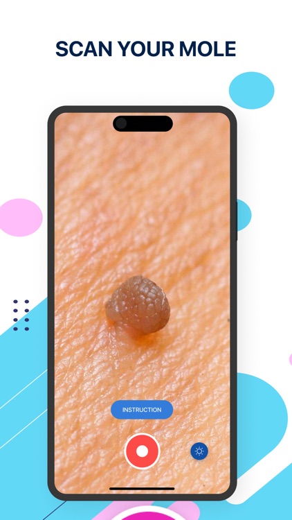 SkinCheck AI dermatologist