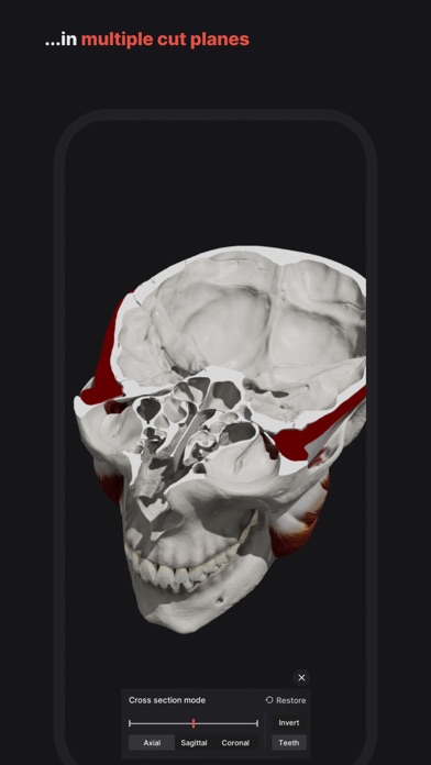 Skull, Teeth & TMJ Screenshot