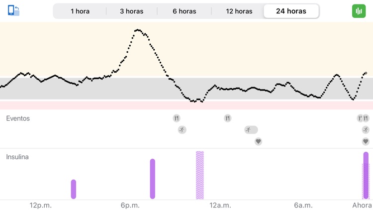 Dexcom G6 mg/dL DXCM2