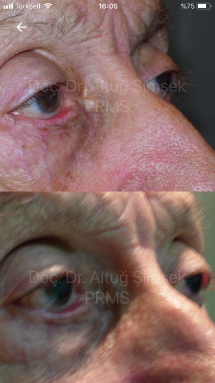 PRMS Hasta Kayıt Bulut Servisi