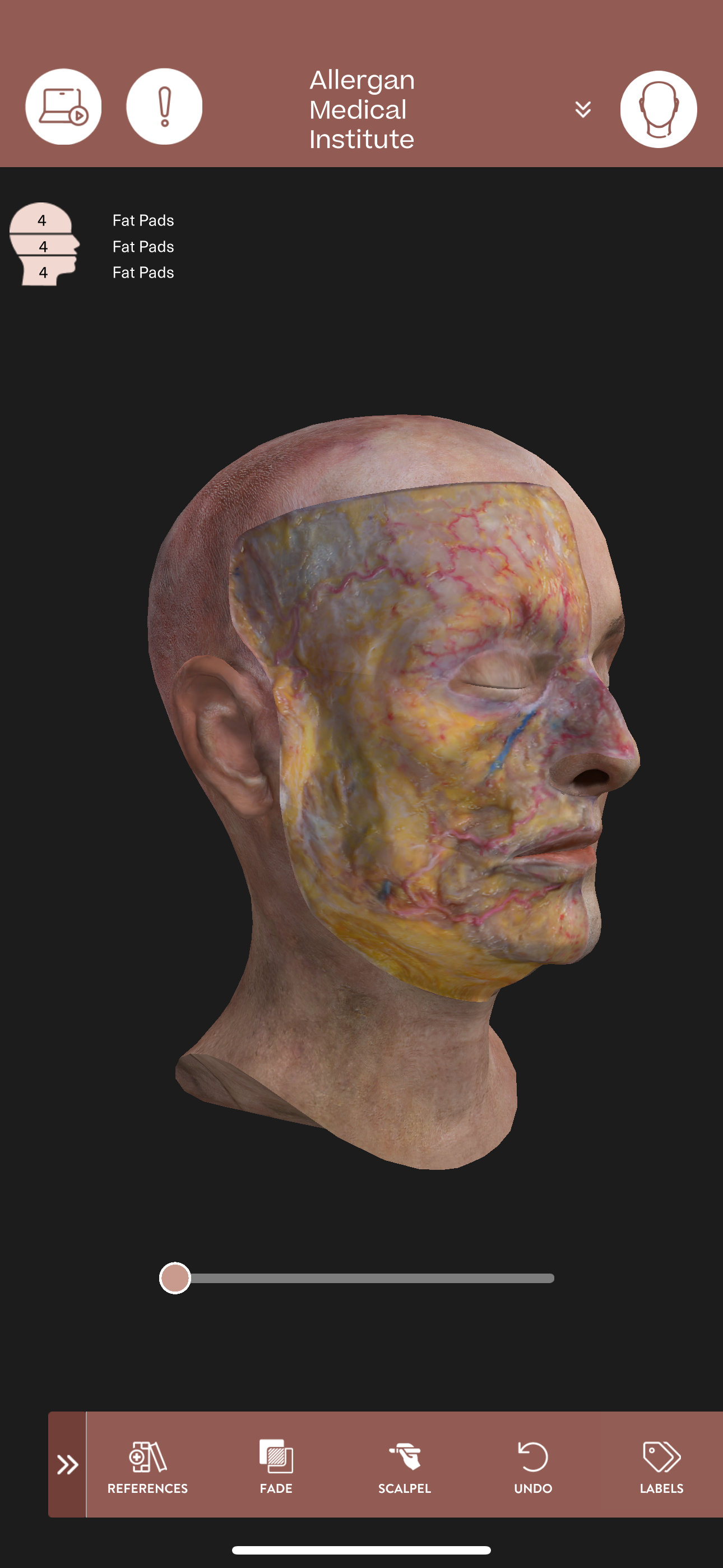 AMI Essentials: 3D Anatomy ND screenshot 7