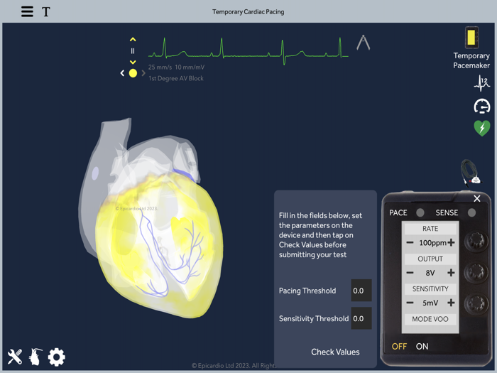 Temporary Cardiac Pacing
