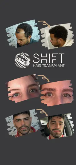 Game screenshot SHIFT Hair Transplant mod apk