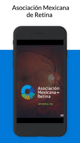 Game screenshot Asociacion Mexicana de Retina mod apk