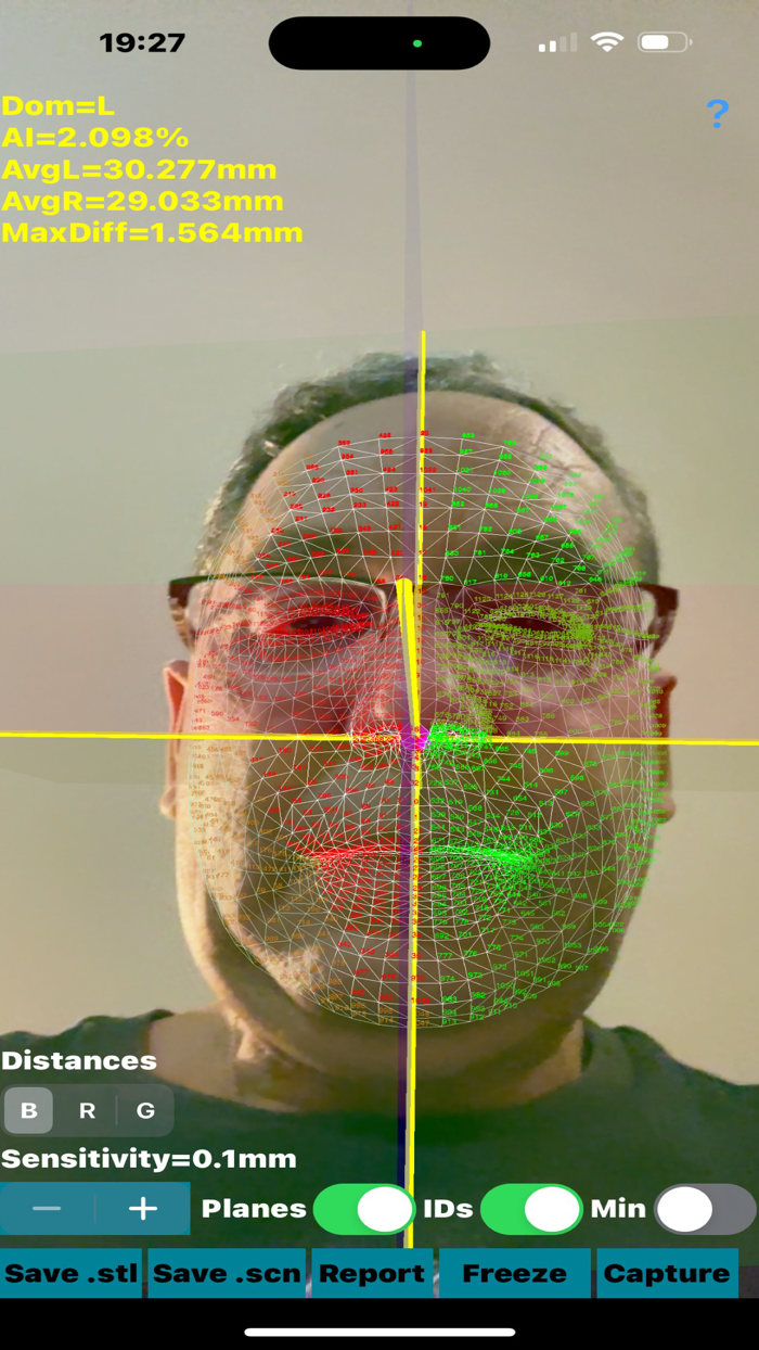 Dynamic3DFaceAsymmetryApp