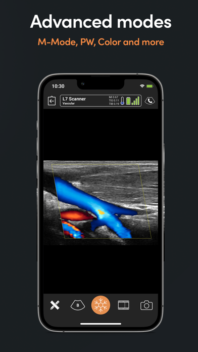 Clarius Ultrasound Appのおすすめ画像4