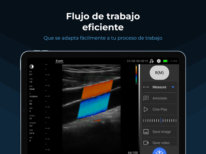 SonoExpert - MediExpert