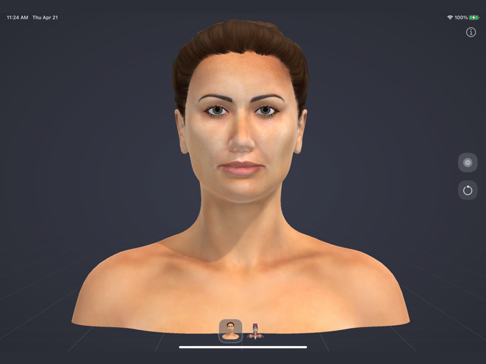 Chronic Migraine Anatomy