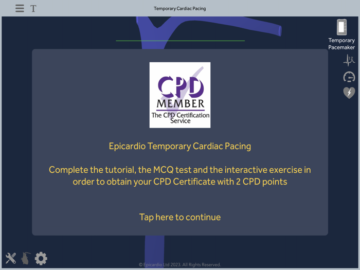 Temporary Cardiac Pacing