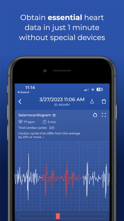 HeartScan: Heart Rate Monitor