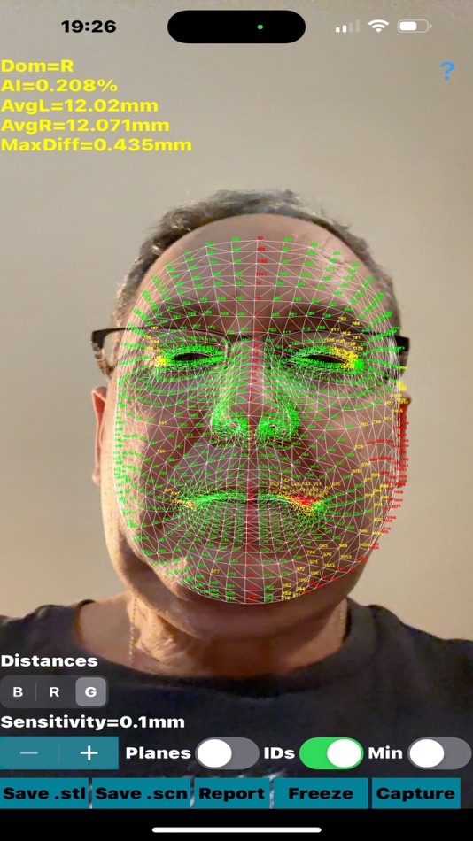 #2. Dynamic3DFaceAsymmetryApp (iOS) Podle: ORTHOPRACTIS.COM SINGLE MEMBER P.C.