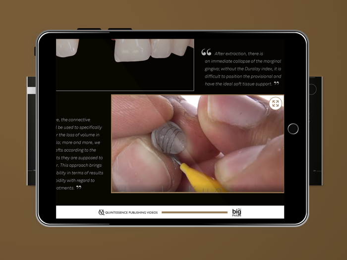 Quintessence The big Picture