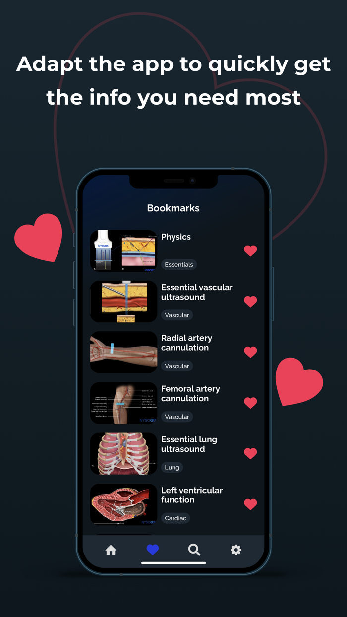 Point of Care Ultrasound