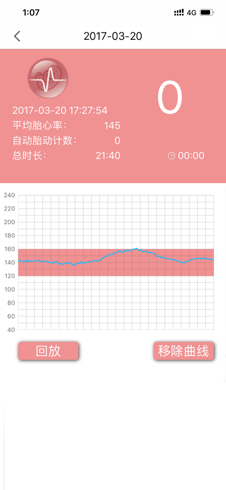 IMAMI Fetal Doppler screenshot 3