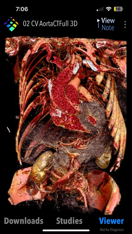 MedVizi™ CT-MRI Viewer