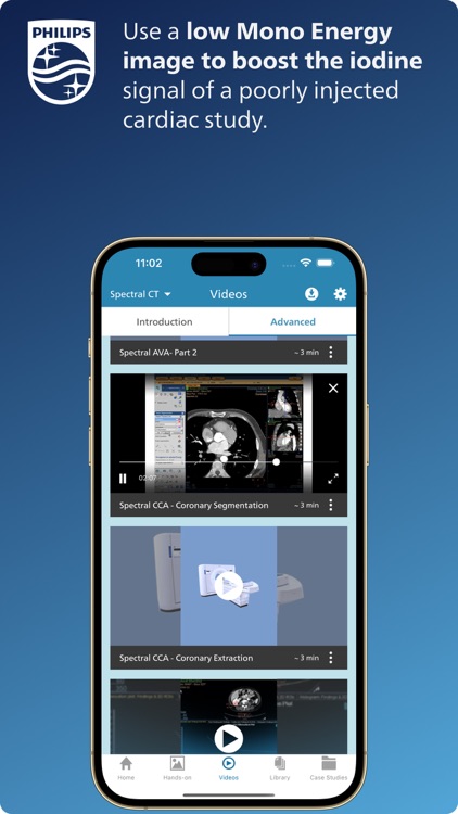 Philips CT Learning screenshot-7