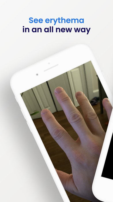 Erythema Screenshot
