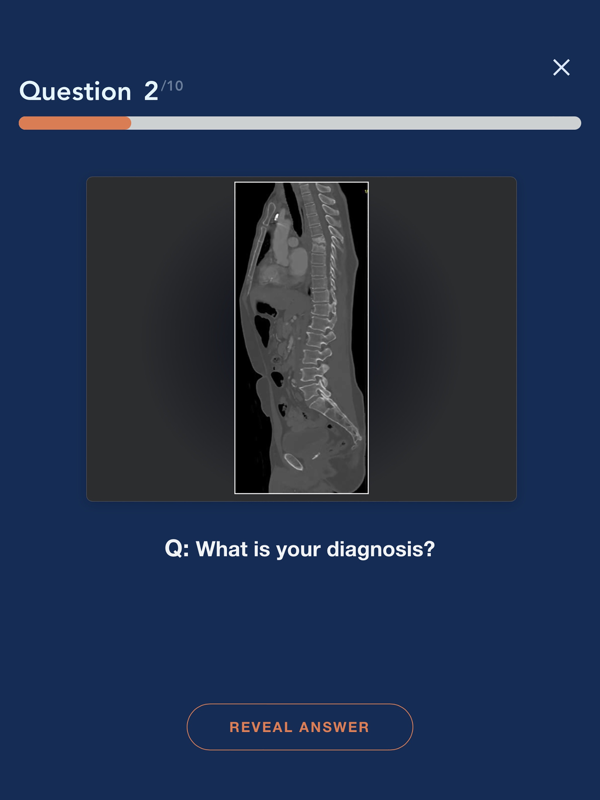 CTisus L-Spine Pathologyのおすすめ画像5